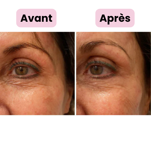 Appareil de beauté raffermissant pour le visage